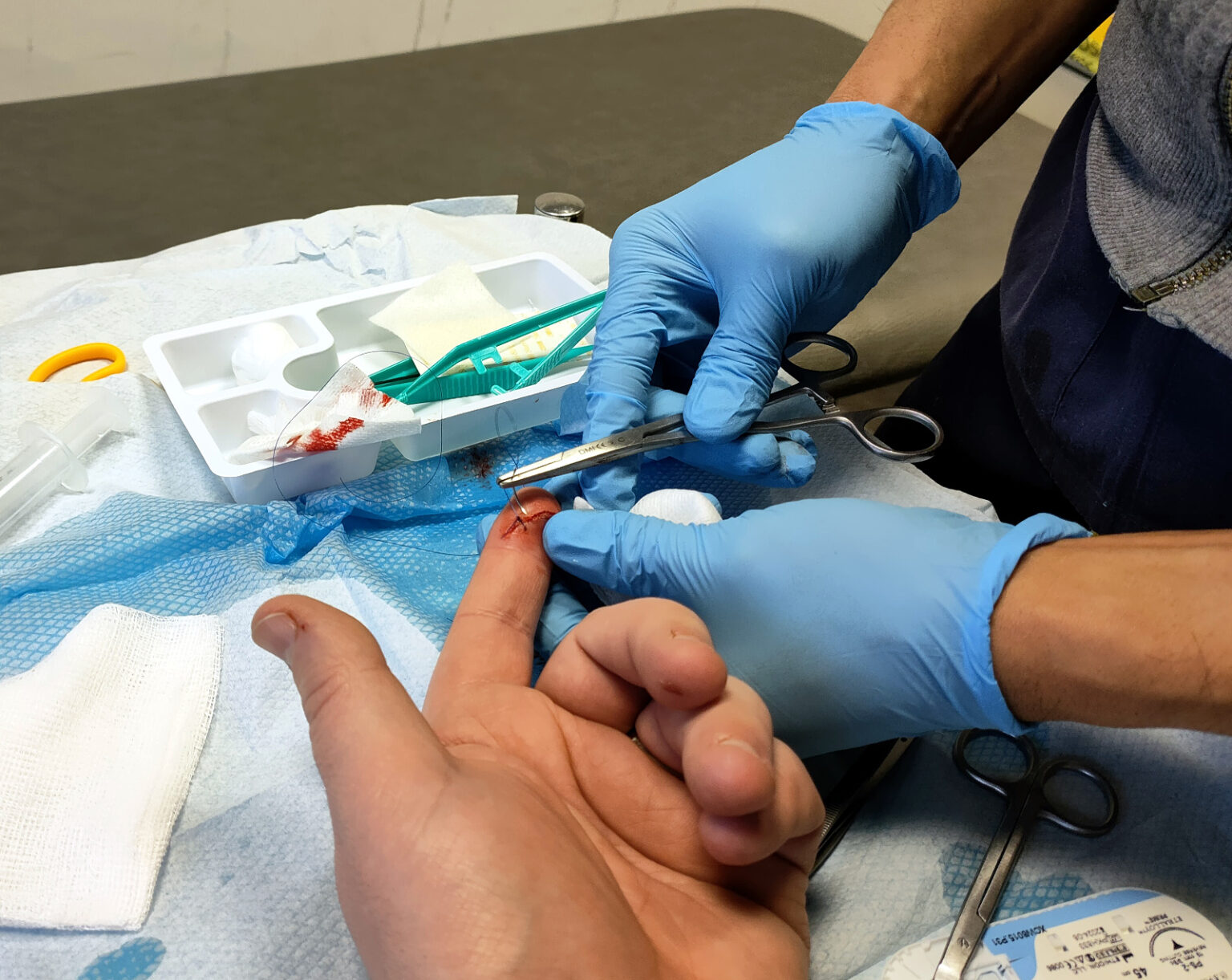 Whoopsie (minor bandsaw injury)… Stochastic Geometry