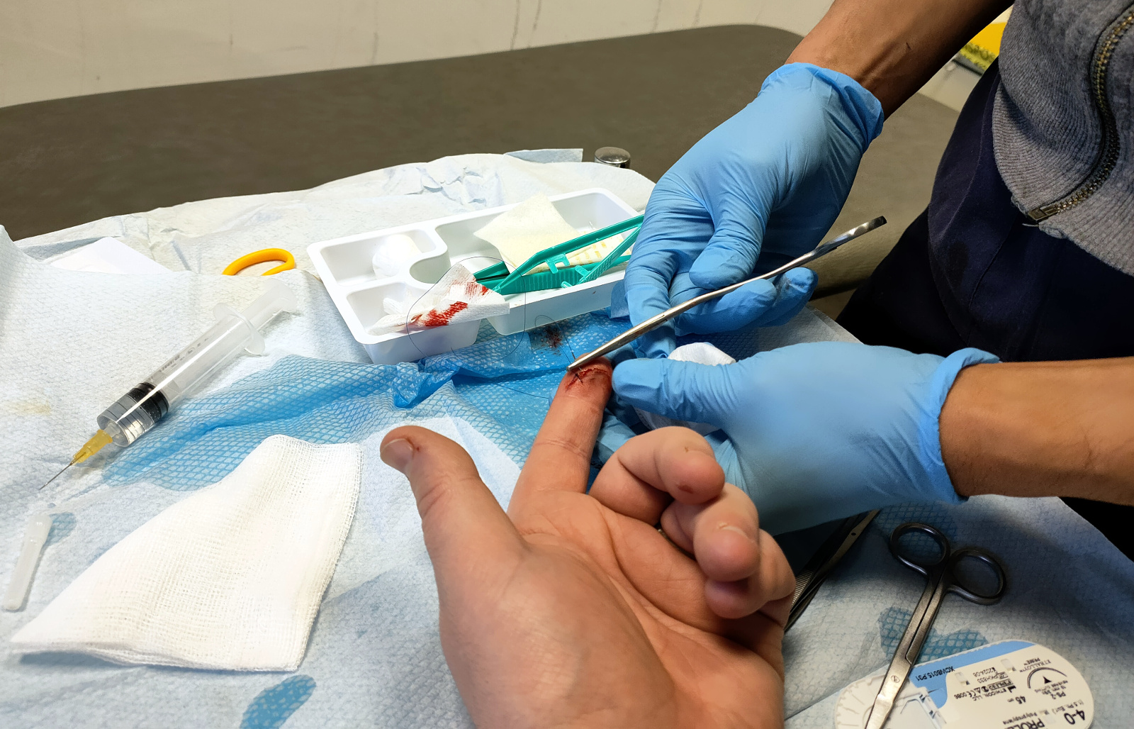 Whoopsie (minor bandsaw injury)… Stochastic Geometry